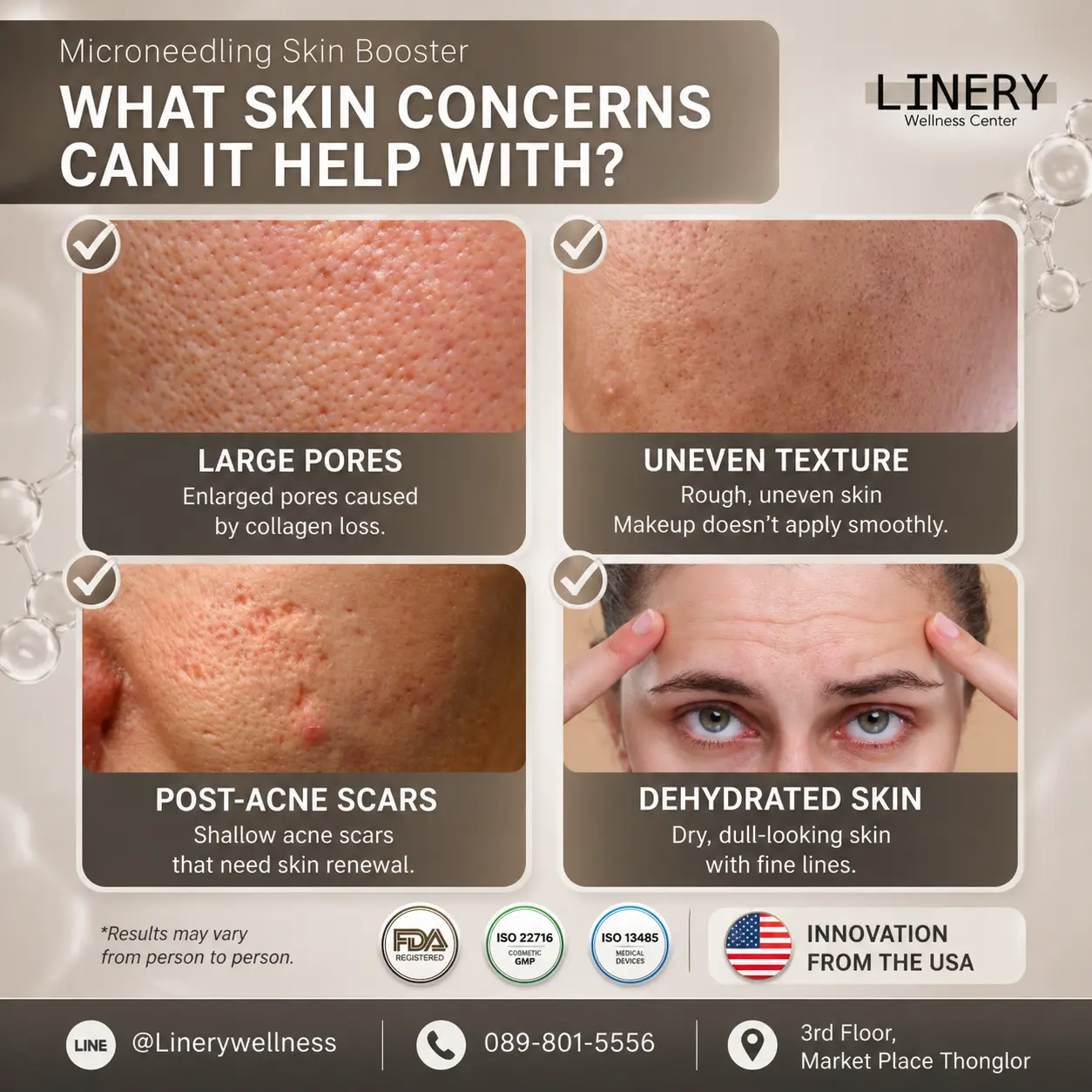Microneedling Skin Booster what skin concern can it help with