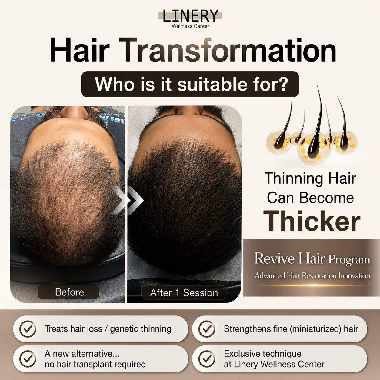 Hair Transformation who suitable