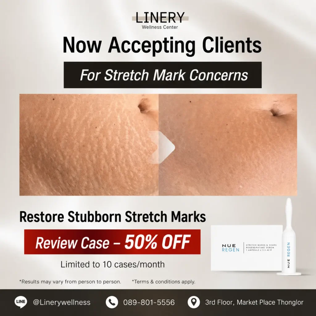 Stretch Mark Regen promotion