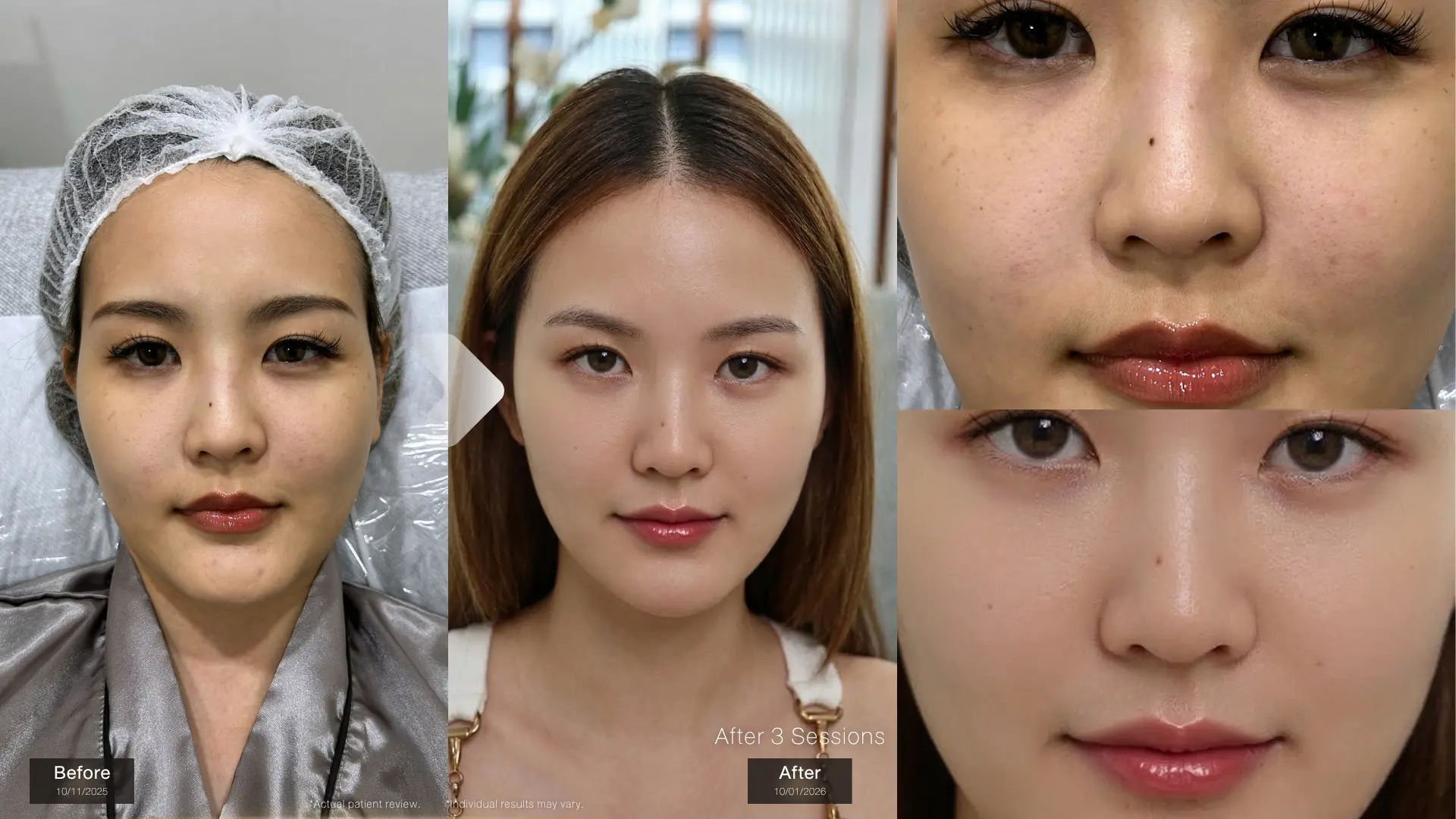 รีวิวจากลูกค้า Linery