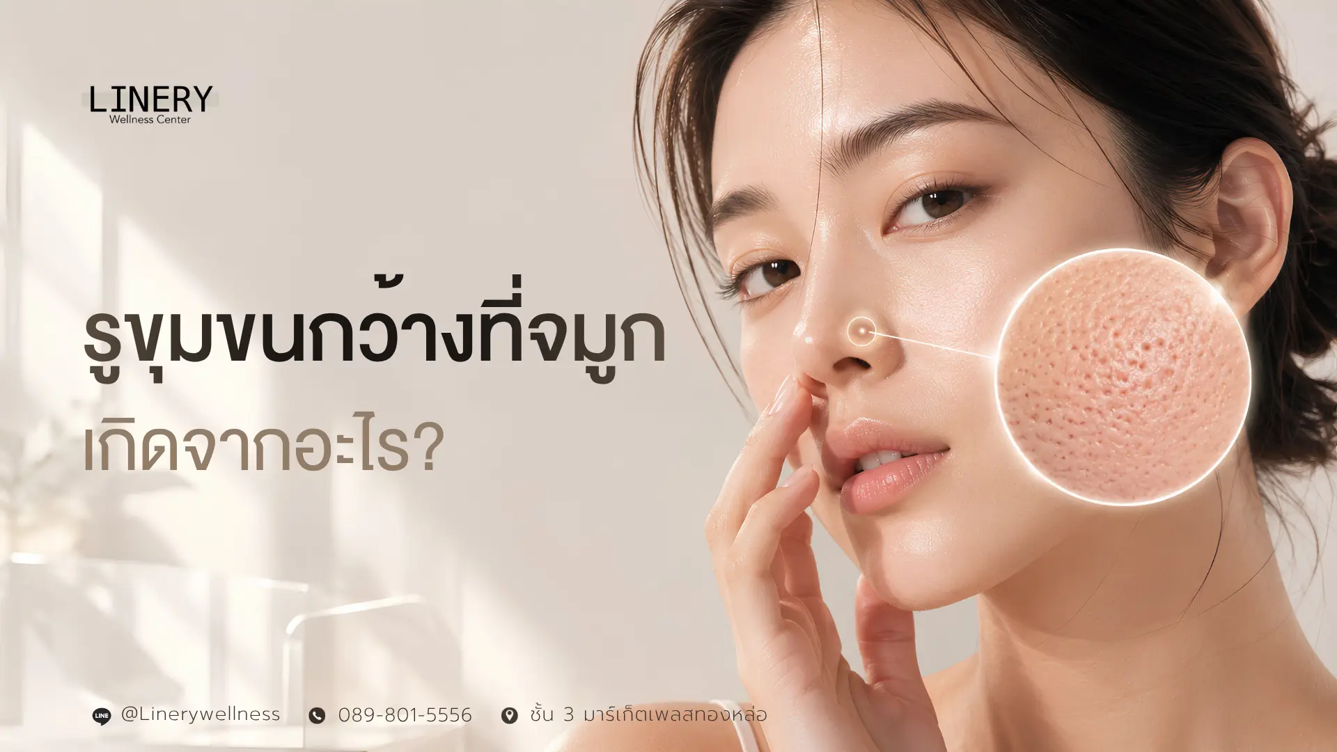 รูขุมขนจมูกกว้างเกิดจากอะไร