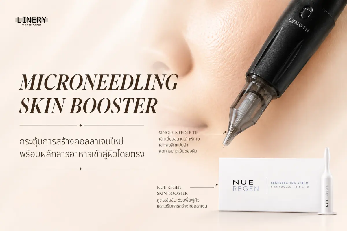 Microneedling เหมาะกับหลุมสิวแบบไหน