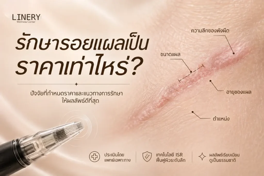 ลบรอยแผลเป็น ราคาเท่าไร? เช็กค่าใช้จ่ายก่อนรักษา