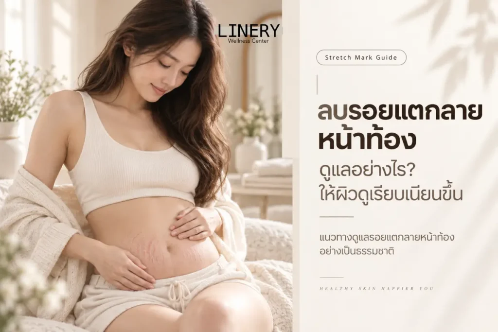 ลบรอยแตกลายหน้าท้อง