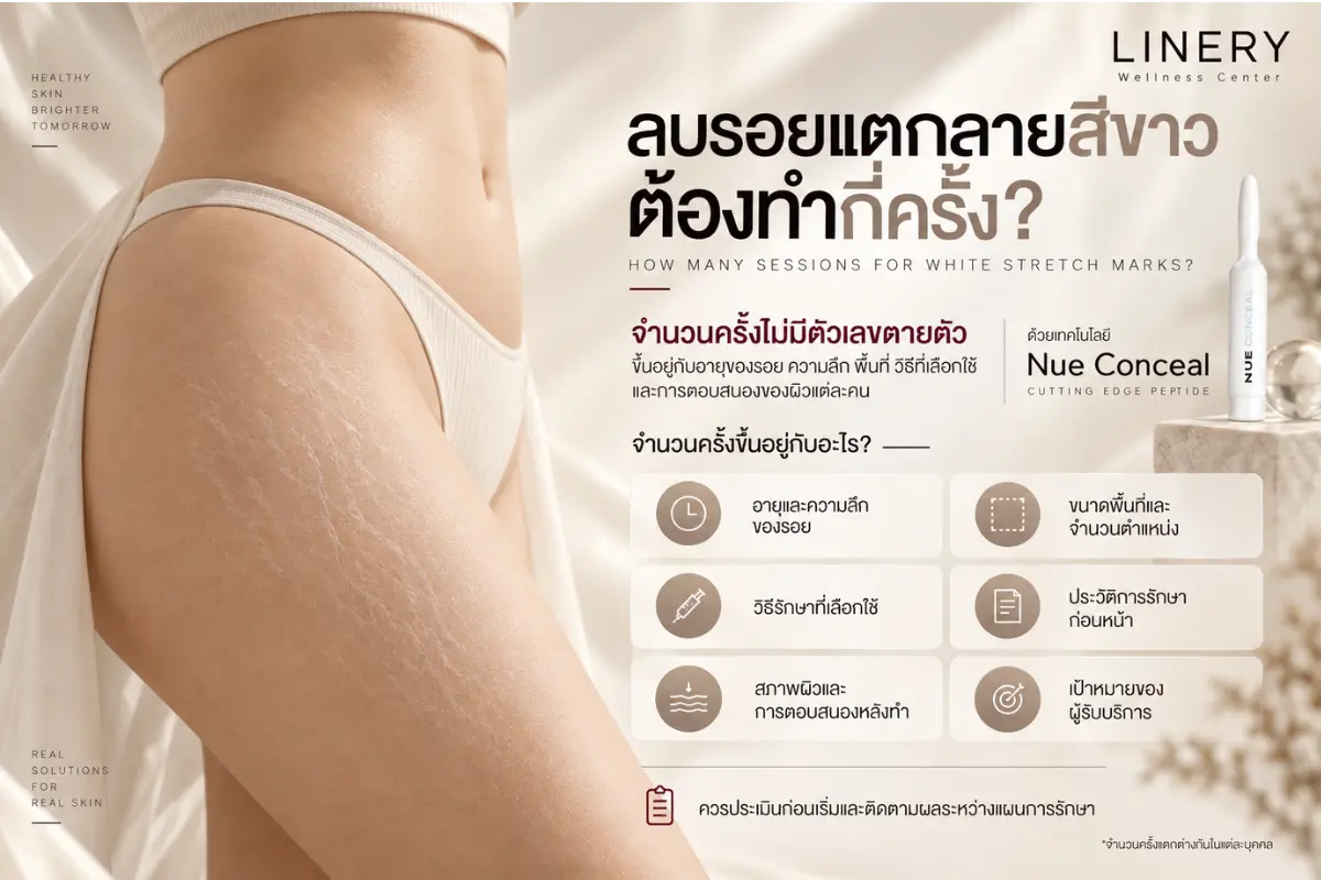 ลบรอยแตกลายสีขาวต้องทำกี่ครั้ง